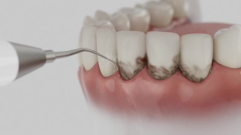Trusted Root Canal Treatment service in Fuller Heights, FL - Dentist Open Now